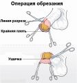 Миниатюра для версии от 03:36, 19 марта 2022